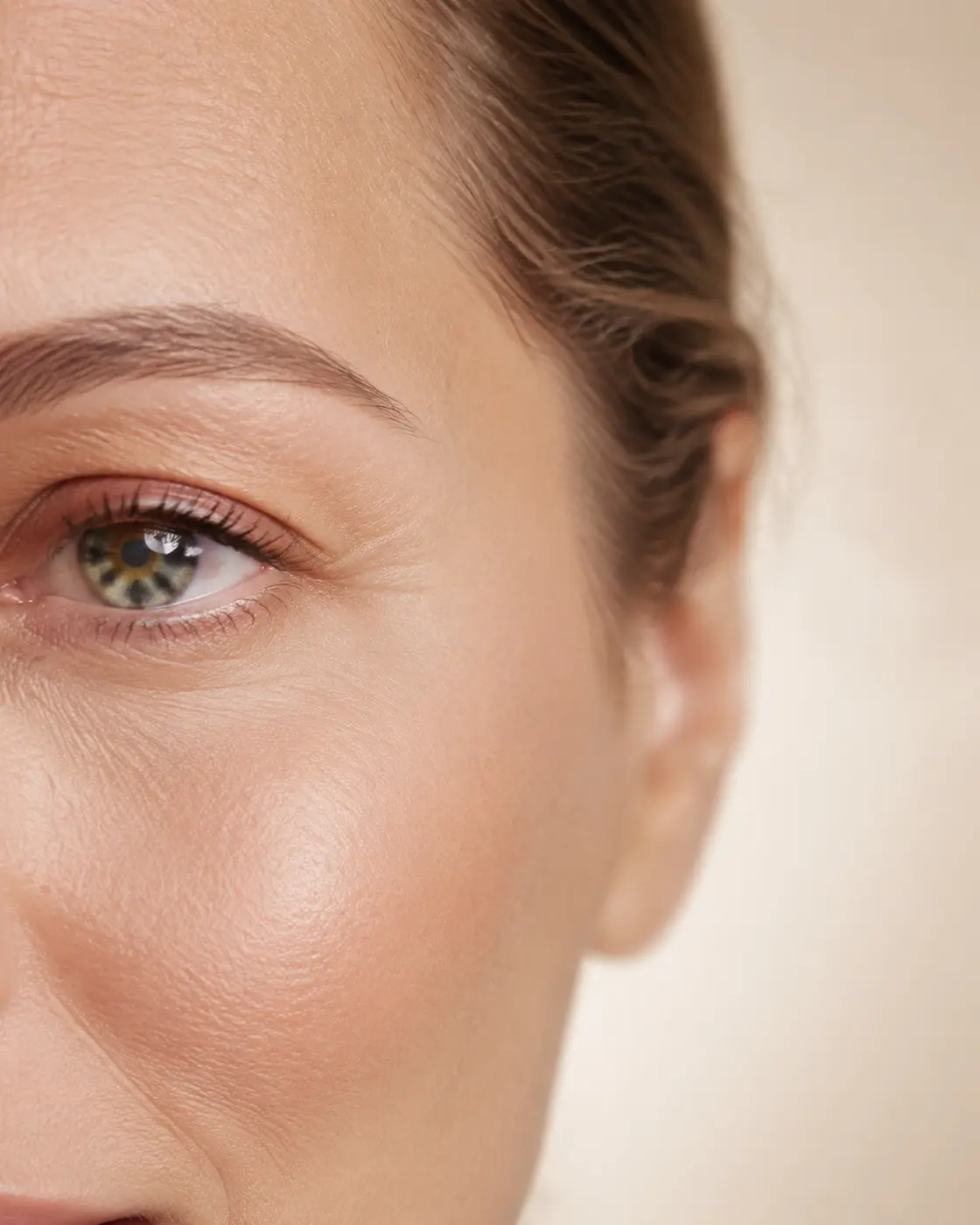 Piel periocular para tratamiento con Jett Plasma Lift
